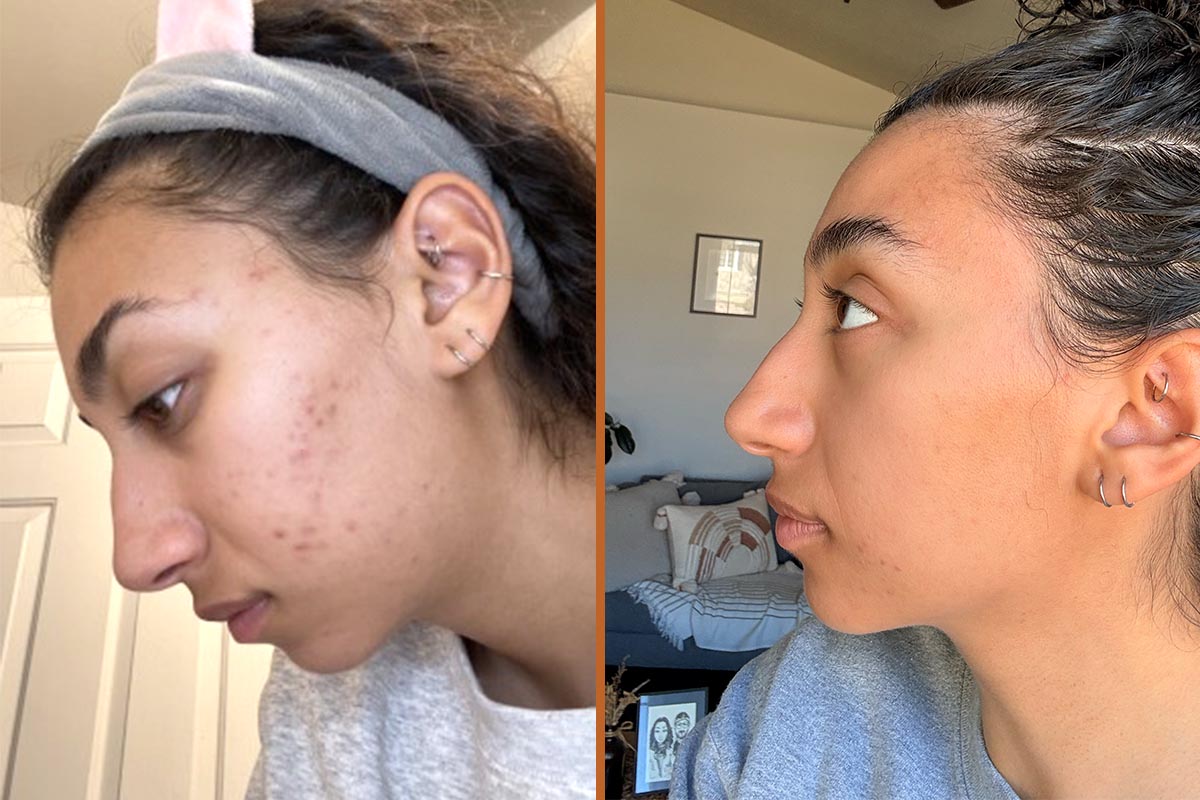 Christa-Before-After