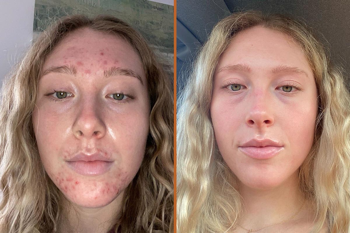 Kyra-Before-And-After